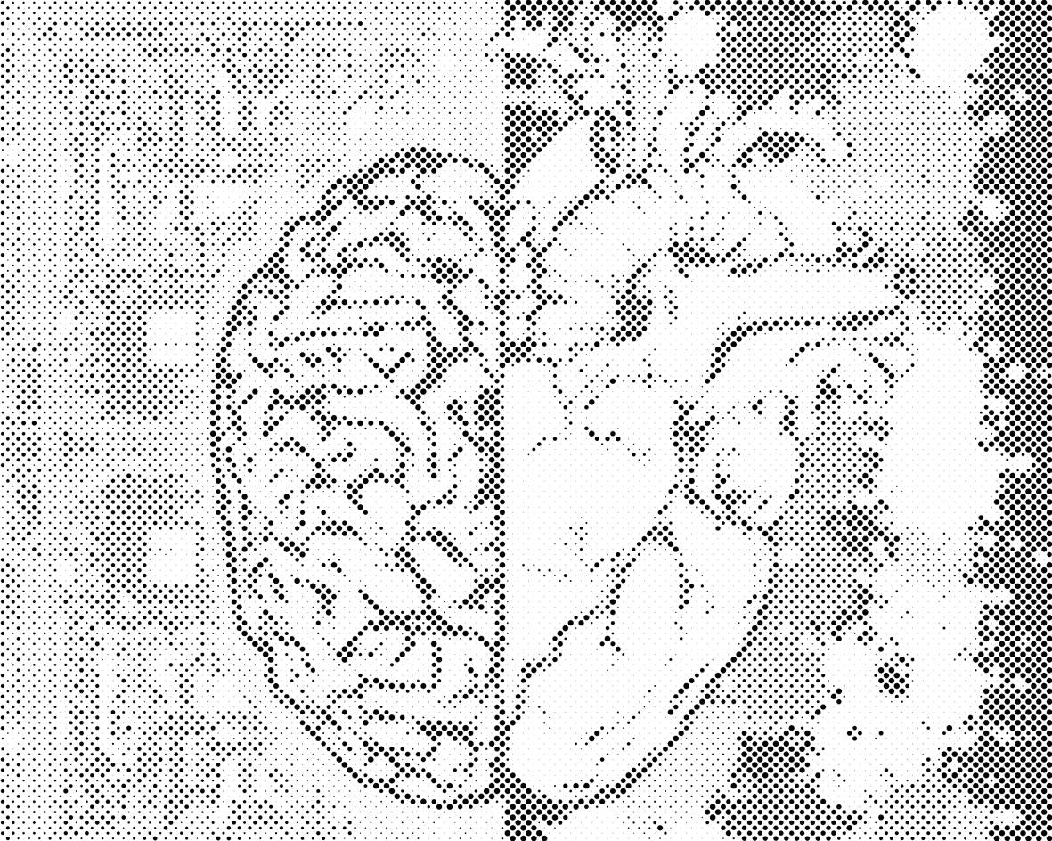 Mozak ili srce? - Dottingo